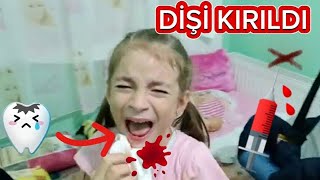 Elif Sinem Masal Dişi Koptu Eyvah Çok Ağladı Üzüldü Çok [upl. by Anitsej]