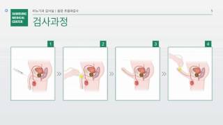 비뇨기과 검사실 음경 초음파 검사 안내환자설명자료 [upl. by Juliette]