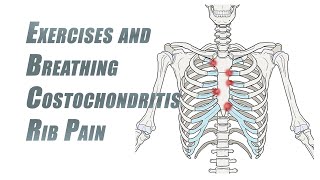 Exercises and Breathing Tips for Rib Pain  Costochondritis [upl. by Jonah]