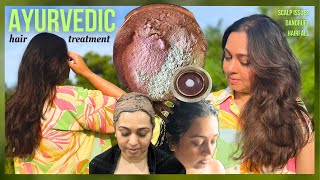 AYURVEDIC Hair Treatment for hairfall amp dandruff  Ayurveda Hair Care results before amp after [upl. by Aruam]