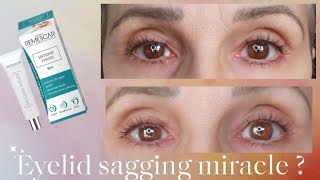 Sagging Eyelids is this gel a miracle [upl. by O'Neil]