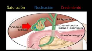 Fisiopatologia de la colelitiasis [upl. by Hsak753]