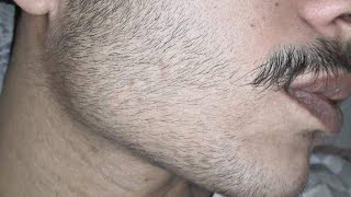 Minoxidil beard journey  The first shaving beard [upl. by Zigmund389]