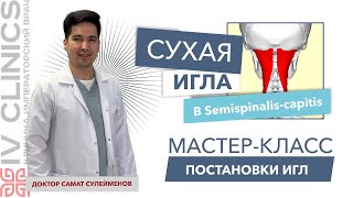 Сухая игла в SEMISPINALIS CAPITIS Полуостистая мышца  Мастеркласс постановки сухой иглы [upl. by Sandro973]