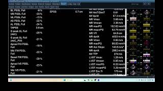 IQ 280 HEMODYNAMIC ECHOCARDIOGRAPHY ECHOPAC ANALYSIS REPORT [upl. by Eilac]