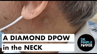 A Diamond DPOW in the Neck [upl. by Akelam617]