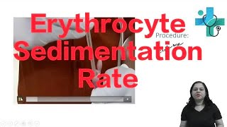 Erythrocyte Sedimentation Rate  haematology  physiology practical [upl. by Rudwik]