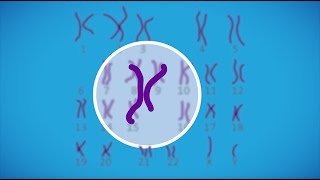 Prenatal testing for chromosomal abnormalities [upl. by Tihor642]