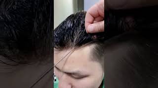 NonSurgical Replacement Hair System  No More Rogaine Minoxidil  Thinning Hair Solution [upl. by Necyla]