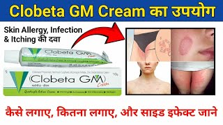 Clobeta GM l दादखाद खुजली कि दवा l Anti Fungal Anti Bacteria l लगाने से पहले वीडियो देख लें [upl. by Atener]