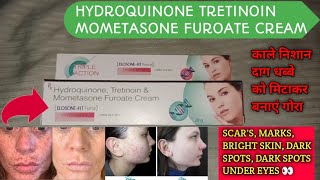 ElosoneHT cream review  Hydroquinone tretinoin Mometasone Furoate Cream  use in hindi [upl. by Aliekahs111]