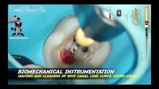 enjoying endodontic treatment using e connect pro endomotor and one curve micromega pop dentistry [upl. by Izy]