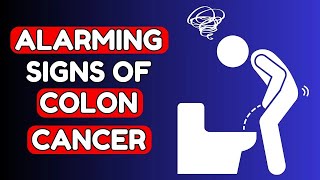 8 Warning Signs of COLON CANCER you Shouldnt Ignore  Nourish Hub [upl. by Angeline633]