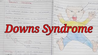 Downs Syndrome  Trisomy 21  Mongolism  Notes With Diagrams To Understand Better  Cx and Features [upl. by Riatsala547]