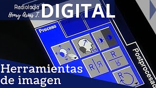 Herramientas de Imagen Radiología Digital [upl. by Ihcur]