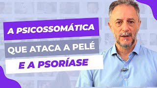 A psicossomática da Psoríase  a doença que ataca a pele psiquiatra [upl. by Barbaresi311]