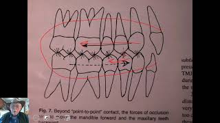 The forces on our teeth are overlooked often  Accidental discovery [upl. by Robbert]