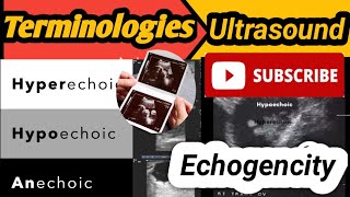 hypoechoic meaningTerminologies used in ultrasoundEchogenicity of Ultrasound [upl. by Seugirdor]