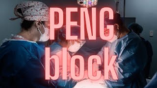 Podcast PENG Block  Pericapsular Nerve Group Block  2024 [upl. by Musette106]