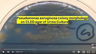 Pseudomonas aeruginosa growth on CLED agar of Urine Culture [upl. by Rior]