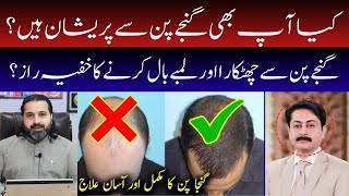 Ganjapan Ka Aasan Ilaj l Hair Fall Solution  100 Sar Ke Baal Ayega  Zanjani podcast [upl. by Hazlip]