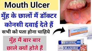 मुँह के छाले mouth ulcer  की medicine  Stomatitis treatment [upl. by Drofniw657]