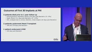 ISHLT 2023 Piedmont Heart Institute Experience with Barostim by Dr Robert T Cole [upl. by Irat133]