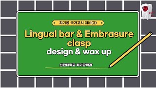 치기공 국가고시 03 Lingual bar amp Embrasure clasp [upl. by Lorollas22]