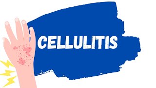 Cellulitis Skin Infection  Treatment erysipelas [upl. by Enaej999]