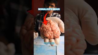 Whats inside RONALDOS brain🤣 ronaldo science shorts messi [upl. by Miehar313]