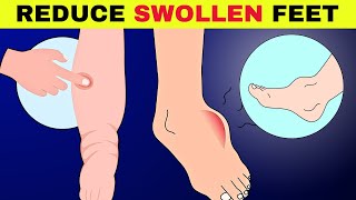 6 Natural Ways To Reduce Swollen Feet amp Ankle FAST That Actually Work [upl. by Laehcimaj]