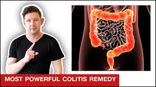 How To QUICKLY Stop Colitis amp Ulcerative Colitis [upl. by Nitnerb756]