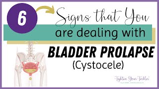 6 Signs That You Are Dealing With Bladder Prolapse Cystocele  What You Can Do About It [upl. by Combes]