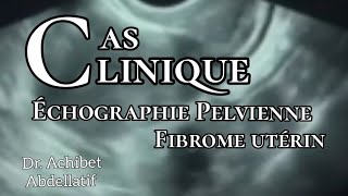 Dr Achibet  formation  Échographie pelvienne  fibrome utérin [upl. by Maye]