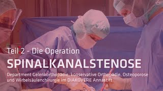 Operation einer Spinalkanalstenose an der Halswirbelsäule  DIAKOVERE Annastift Hannover [upl. by Puritan]