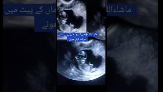 healthy baby movements pregnancy ultrasound 🥰🥰🥰 viralvideo trending baby [upl. by Cynthie943]