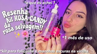 RESENHA DO KIT ROSA CANDY 🌸 para manchas escuras e foliculite na virilha [upl. by Aisnetroh5]