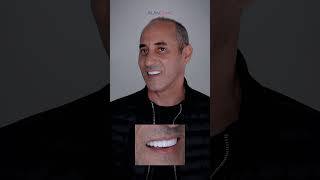 dentist hollywoodsmileturkey dentalcare smilemakeoverturkey dentalprocedure beforeandafter [upl. by Lance]