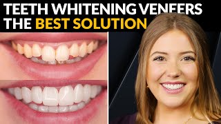 Whiten Your Teeth Like a Pro  The Secret Tip No One Tells You [upl. by Celina]