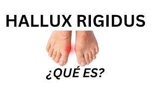 Hallux Rigidus HALLUXRIGIDUS JUANCALBORNOZ CIRUGÍAMÍNIMAMENTEINVASIVA [upl. by Rialb]