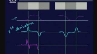 Lecture  29 Image Segmentation  I [upl. by Nhguavahs]