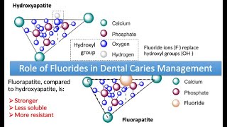 Role of Fluorides in Dental Caries Management [upl. by Averi]