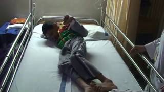 Preoperative Assessment for Dystonic Cerebral Palsy  Dr Paresh K Doshi [upl. by Ecinev]