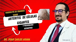 Polimialgia reumática y arteritis de células gigantes [upl. by Dielle838]