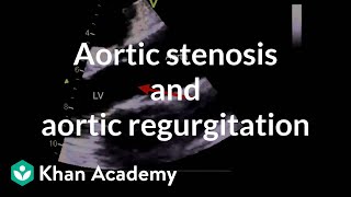 Aortic stenosis and aortic regurgitation  Circulatory System and Disease  NCLEXRN  Khan Academy [upl. by Coop]