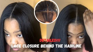 HOW TO LACE CLOSURE BEHIND THE HAIRLINE 💁🏾‍♀️ [upl. by Phebe]