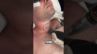 How Exactly Does Laser Tattoo Removal Actually Work 📸 lasertat [upl. by Feld75]