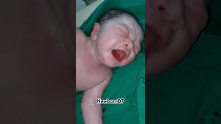 Newborn baby is crying for the first time  welcome to the world cute baby cute newborn shorts [upl. by Benjamin665]