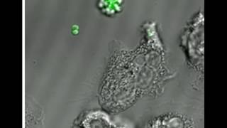 Phagocytosis of MRSA by a human neutrophil [upl. by Enelram506]