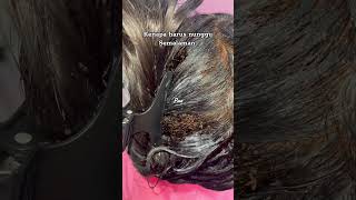 Picking a thousand of lice on hair How to get rid of lice hair wigs skincare 2 3 [upl. by Donetta]